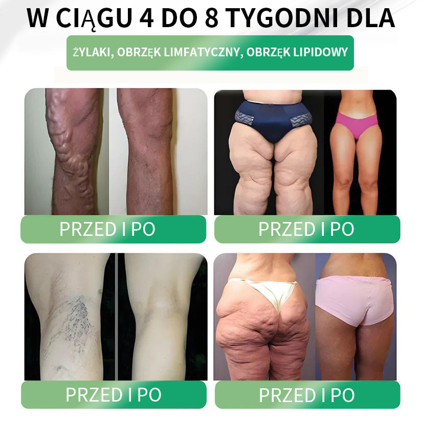 Widoczne rezultaty w 7 dni 🏆 | Lercea® GLP-1 Doustny Roztwór Odchudzający – 🌈 Otyłość, Choroby Sercowo-Naczyniowe, Cukrzyca, Bezdech Senny, Problemy ze Stawami i nie tylko